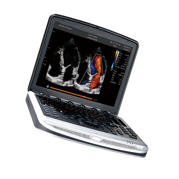 Chison SonoBook 8